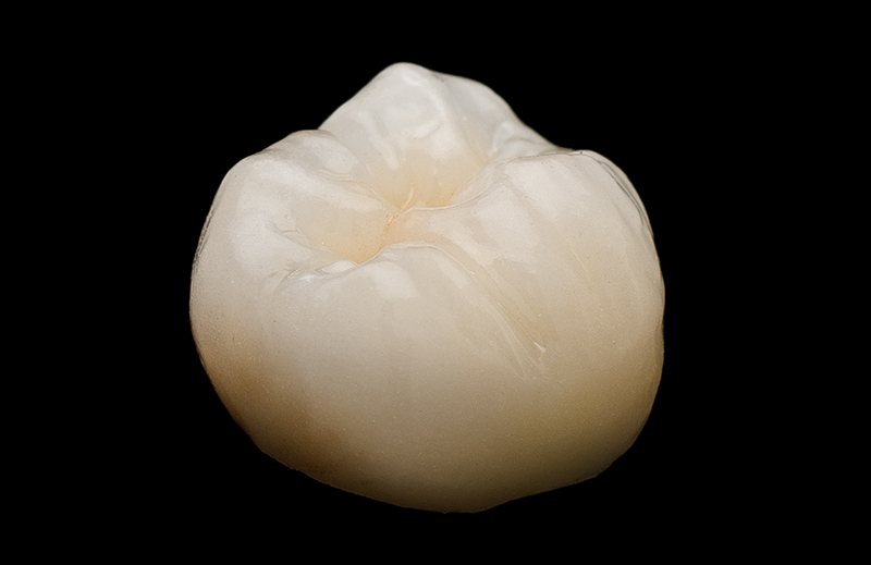 California Dental Arts Elevates Esthetics with MIYO® System